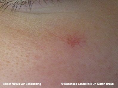 Dr. Martin Braun Laserklinik Bodensee