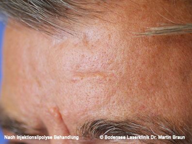 Dr. Martin Braun Laserklinik Bodensee