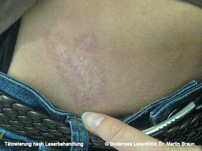 Dr. Martin Braun Laserklinik Bodensee