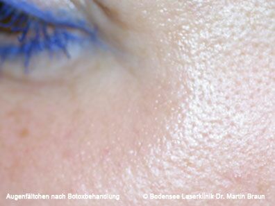 Dr. Martin Braun Laserklinik Bodensee