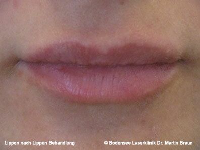 Dr. Martin Braun Laserklinik Bodensee