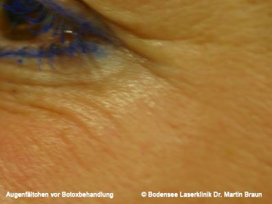 Dr. Martin Braun Laserklinik Bodensee