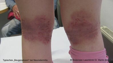 Dr. Martin Braun Laserklinik Bodensee