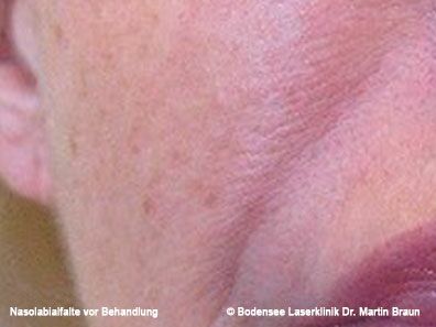 Dr. Martin Braun Laserklinik Bodensee