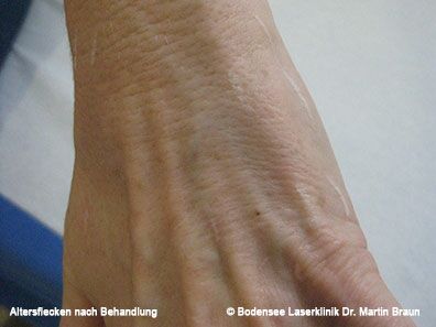 Dr. Martin Braun Laserklinik Bodensee