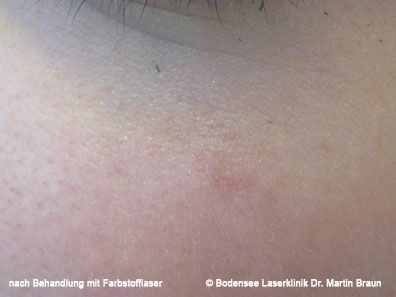 Dr. Martin Braun Laserklinik Bodensee