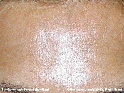 Dr. Martin Braun Laserklinik Bodensee