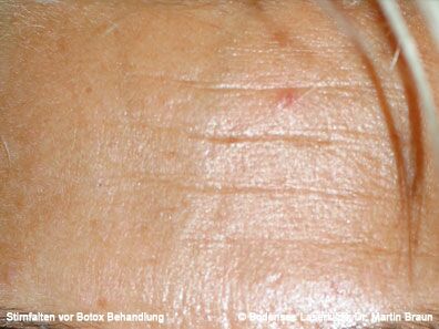 Dr. Martin Braun Laserklinik Bodensee