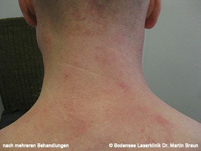 Dr. Martin Braun Laserklinik Bodensee