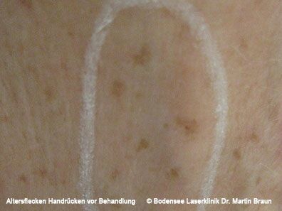 Dr. Martin Braun Laserklinik Bodensee