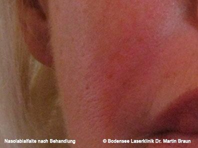 Dr. Martin Braun Laserklinik Bodensee