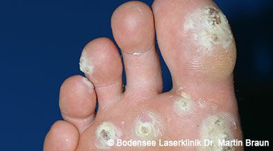 Dr. Martin Braun Laserklinik Bodensee