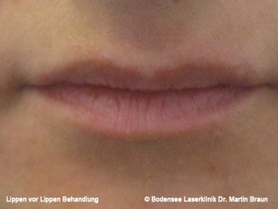 Dr. Martin Braun Laserklinik Bodensee