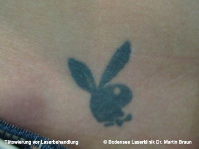 Dr. Martin Braun Laserklinik Bodensee