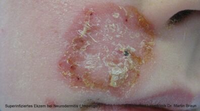 Dr. Martin Braun Laserklinik Bodensee