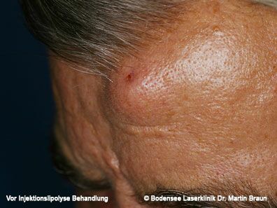 Dr. Martin Braun Laserklinik Bodensee