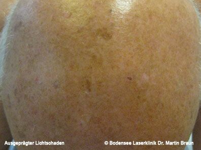 Dr. Martin Braun Laserklinik Bodensee